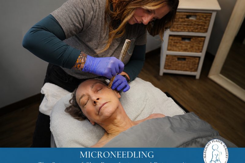 Microneedling-–-The-Science-of-Skin-Resurfacing-and-Rejuvenation
