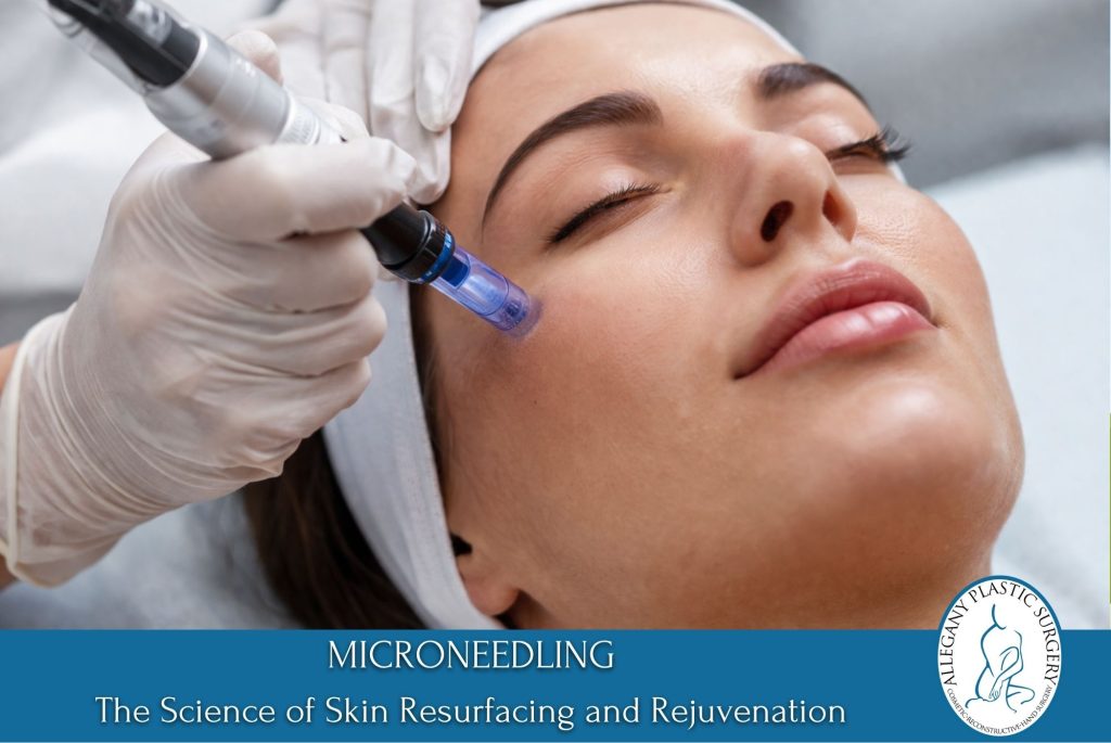 Microneedling – The Science of Skin Resurfacing and Rejuvenation