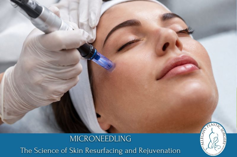Microneedling – The Science of Skin Resurfacing and Rejuvenation
