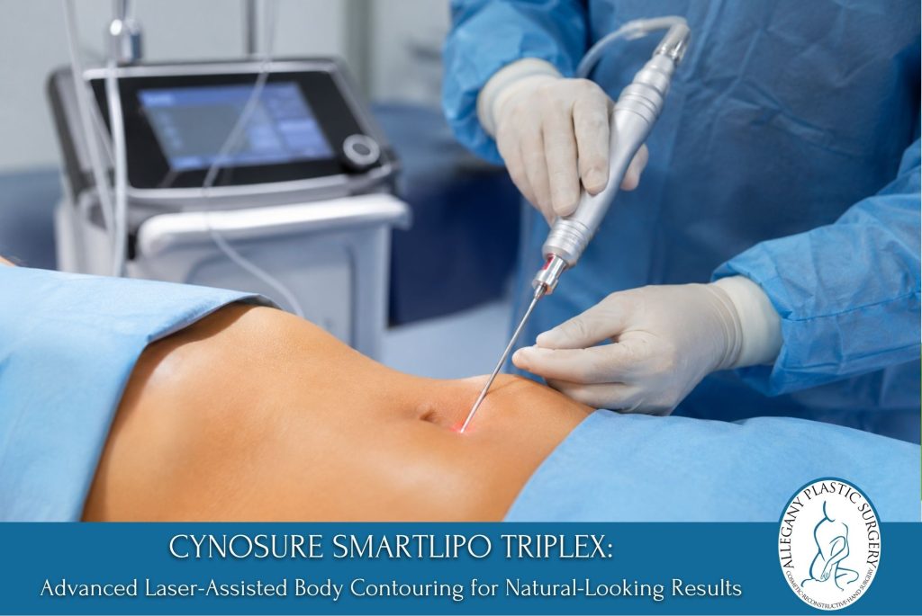Cynosure Smartlipo Triplex Advanced Laser-Assisted Body Contouring for Natural-Looking Results